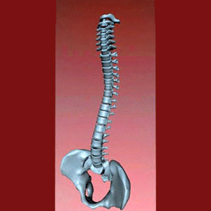 Spinal Fusion for Facet Joint Pain